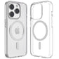 Transparent Back Cover – Slim & Shockproof